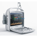 Diagnostischer Doppler Digitaler Doppler-Ultraschall